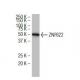 ZNF622 Antibody (3I4) - Western Blotting - Image 34345 