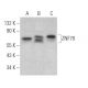 ZNF70 Antibody (F-8) - Western Blotting - Image 369050