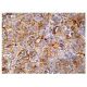 ZNF703 Antibody (E-6) - Immunohistochemistry - Image 161034 
