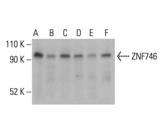 ZNF746 Antibody (C-11) - Western Blotting - Image 401447 
