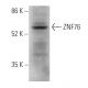 ZNF76 Antibody (F-12) - Western Blotting - Image 368935