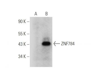 ZNF784 Antibody (B-8) - Western Blotting - Image 319916