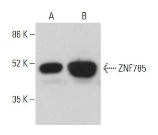 ZNF785 Antibody (C-9) - Western Blotting - Image 378135 