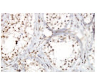ZNF85 Antibody (9A87) - Immunohistochemistry - Image 53912