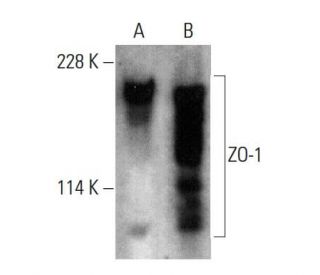 western blotting image from recommended ZO-1 (R40.76) monoclonal antibody replacement. Image 376844