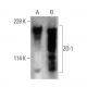 western blotting image from recommended ZO-1 (R40.76) monoclonal antibody replacement. Image 376844