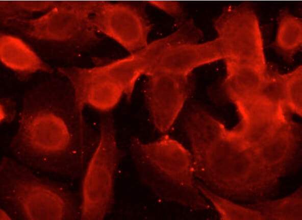 ZO-1 Antibody (R40.76) | SCBT - Santa Cruz Biotechnology