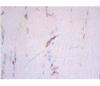 ZO-1 Antibody (R40.76) | SCBT - Santa Cruz Biotechnology