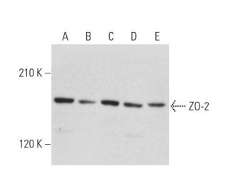 ZO-2 Antibody (E-3) - Western Blotting - Image 344140 