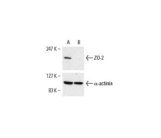 ZO-2 siRNA (h): sc-29833. Western blot analysis of ZO-2 expression in non-transfected control (A) and ZO-2 siRNA transfect 