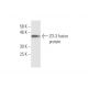 ZO-3 Antibody (1E8) - Western Blotting - Image 349563