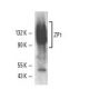 ZP1 Antibody (M1.4) - Western Blotting - Image 11024