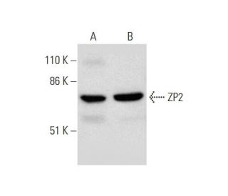 ZP2 Antibody (C-7) - Western Blotting - Image 289825 