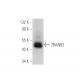 ZRANB2 Antibody (B-5) - Western Blotting - Image 317936