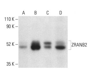 ZRANB2 Antibody (B-5) - Western Blotting - Image 404262 