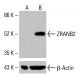 ZRANB2 Antibody (B-5) - Western Blotting - Image 415617 