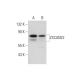 ZSCAN22 Antibody (D-4) - Western Blotting - Image 326514 