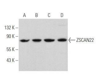 ZSCAN22 Antibody (D-4) - Western Blotting - Image 375949 