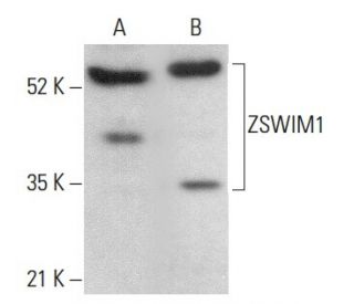 ZSWIM1 Antibody (G-5) - Western Blotting - Image 379587 
