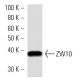 ZW10 Antibody (3363C4a) - Western Blotting - Image 16532
