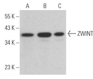 ZWINT Antibody (G-12) - Western Blotting - Image 366803Each CRISPR/Cas9 Knockout (KO) Plasmid product consists of a pool of 3 plasmids designed to ensure identification and cleavage of a specific gene for maximum knockout efficiency. Each plasmid encodes a unique 20 nt sequence derived from the GeCKO (v2) library. 
