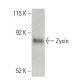 Zyxin Antibody (21) - Western Blotting - Image 397511
