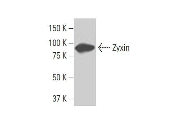 Zyxin Antibody (2D1) | SCBT - Santa Cruz Biotechnology