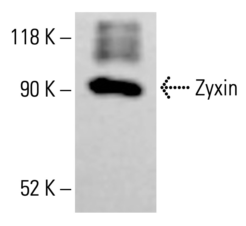 Zyxin Antibody (2D1) | SCBT - Santa Cruz Biotechnology