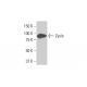 western blotting image from recommended Zyxin (2D1) monoclonal antibody replacement. Image 352159